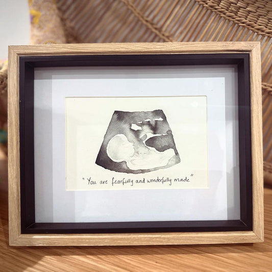 Sonogram Art Piece