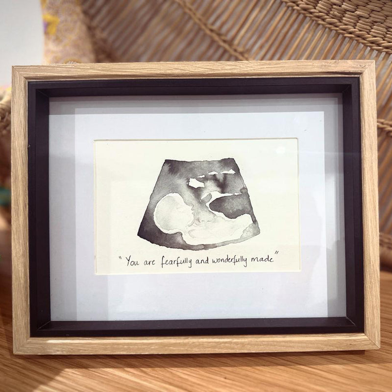 Sonogram Art Piece